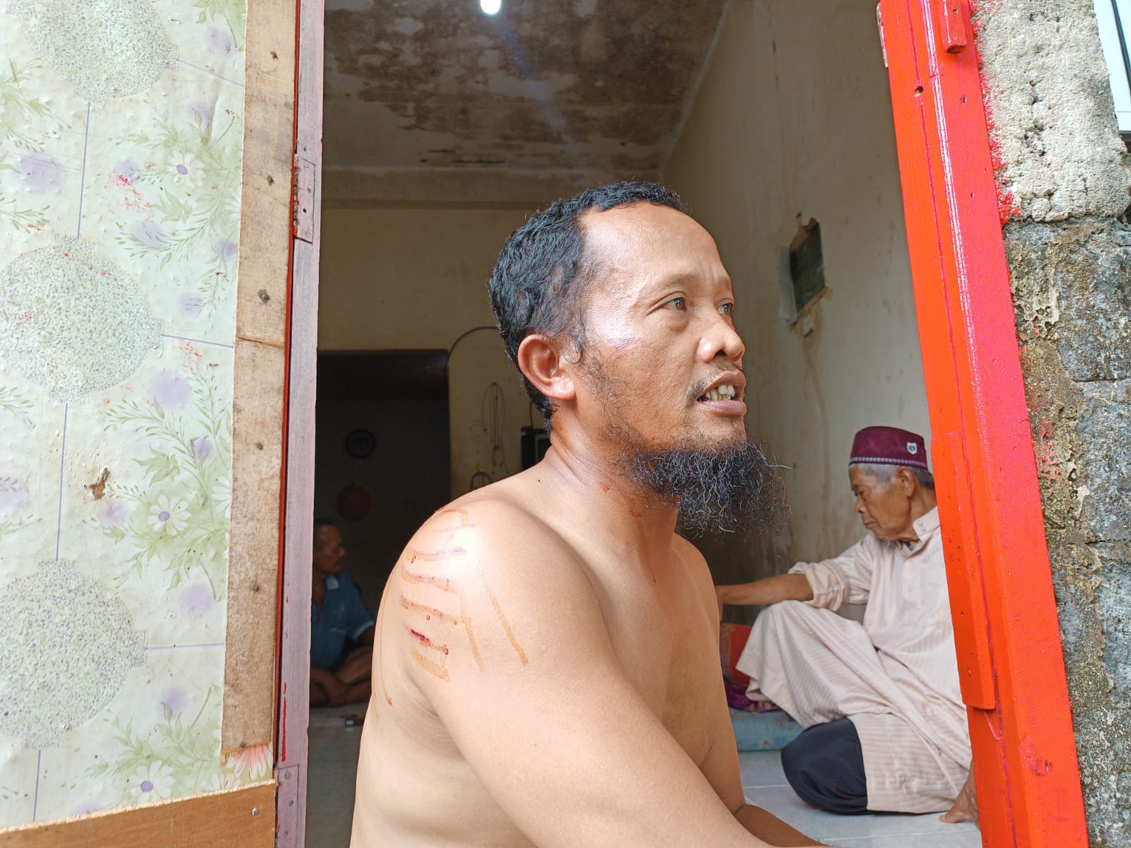 Sugito, nelayan di Tanjungpinang yang berhasil selamat dari terkaman buaya