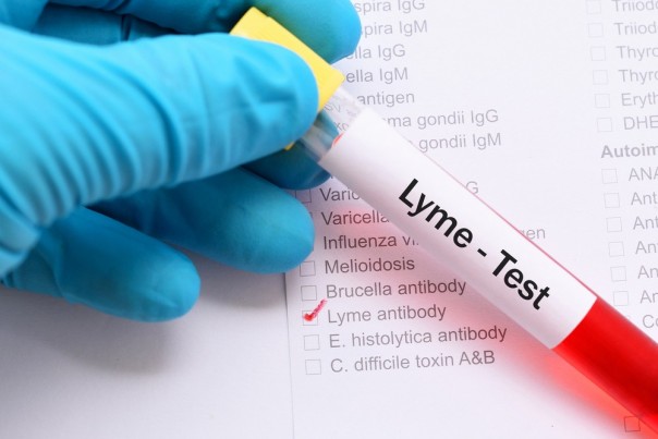 Ini yang Perlu Kamu Ketahui Tentang Penyakit Lyme