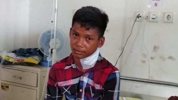 Kisah Heroik Bocah Indonesia yang Berjuang Melawan Ikan Jarum, Jadi Viral di Media Sosial