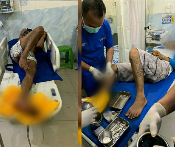 Dua pelaku saat mendapat perawatan medis di RS Bhayangkara, Polda Riau.