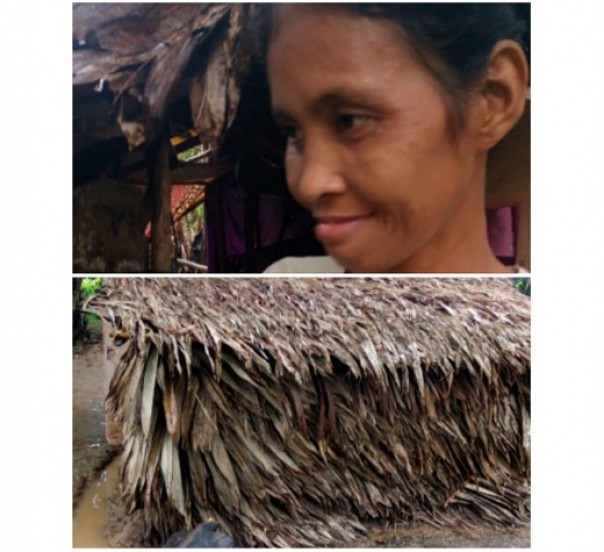 Ibu Isa (40) penderita Bisu Tuli Rabun (Bitura), warga Desa Anak Talang, Kecamatan Batang Cenaku dan kondisi gubuk reyot berukuran 3x3 meter, menunggu uluran para dermawan untuk menyambung hidupnya sehari-hari